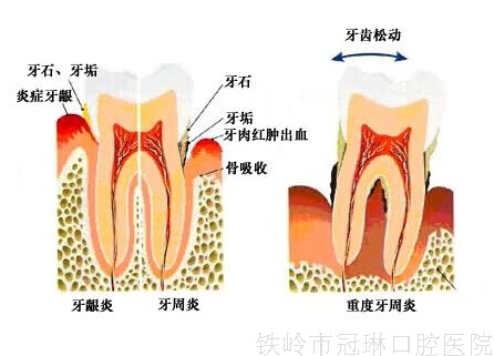 1-140Q51Q504L9.jpg